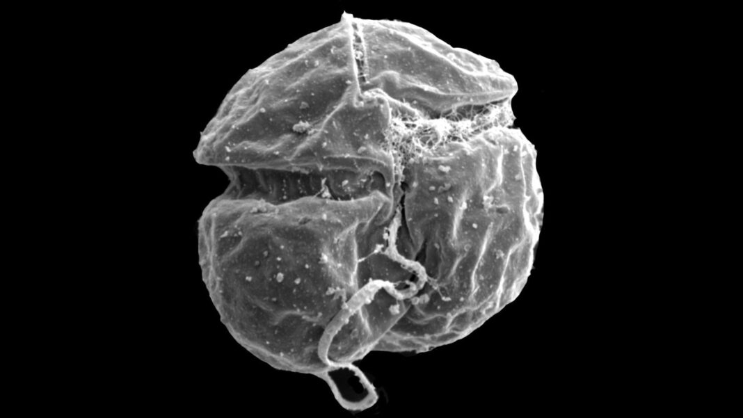 Microalga Karenia cristata al microscopio