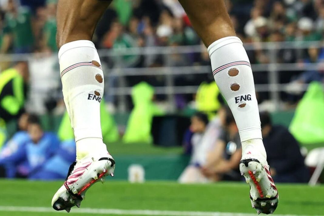 Futbolista con medias cortadas en la pantorrilla durante el Mundial 2026