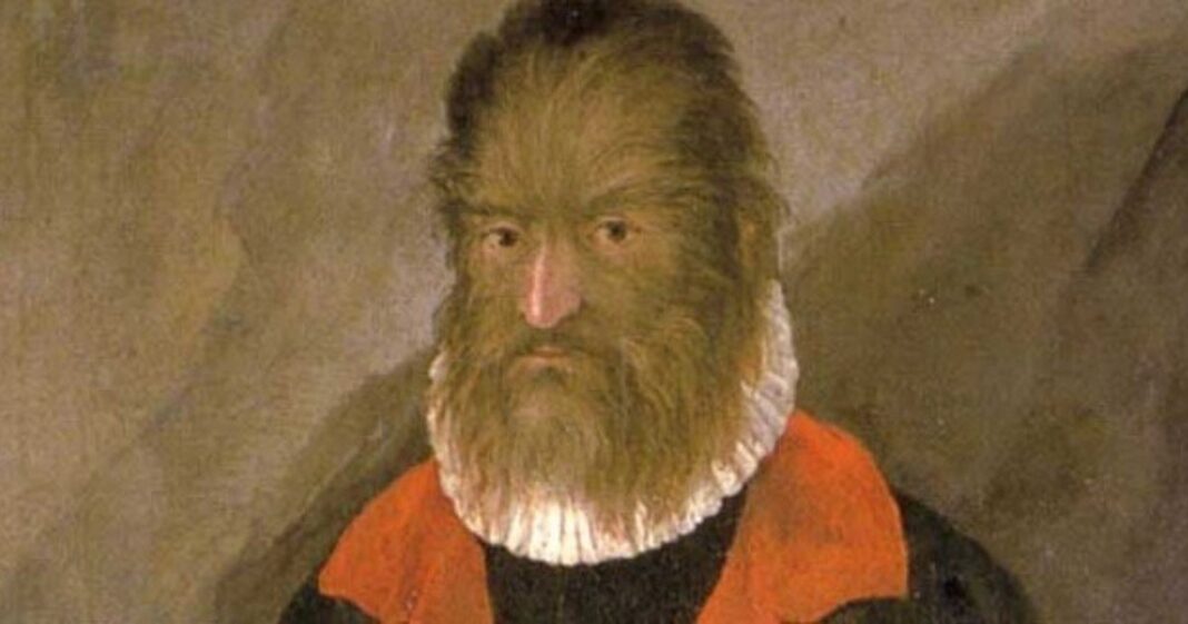 Retrato de Petrus Gonsalvus, conocido como el hombre lobo, en la corte francesa del siglo XVI